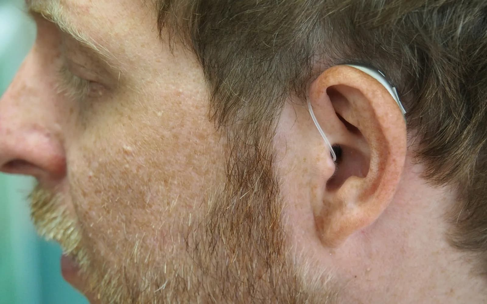 A close-up of a hearing aid fitted in an ear